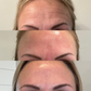 Bare™ Serum Sealing Forehead Tape