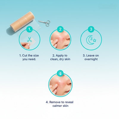 Medical-Grade Hydrocolloid Roll