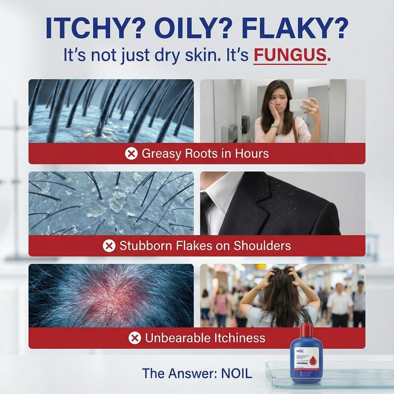 Anti Dandruff Shampoo