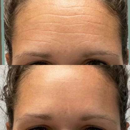 Bare™ Serum Sealing Forehead Tape