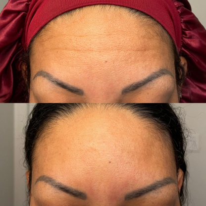 Bare™ Serum Sealing Forehead Tape