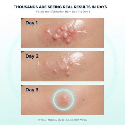 Medical-Grade Hydrocolloid Roll